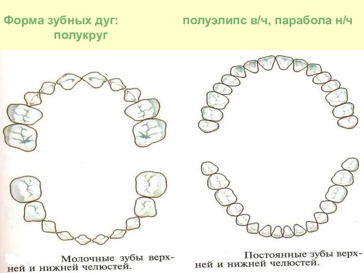 Форма зубных дуг: полуэлипс в/ч, парабола н/ч полукруг