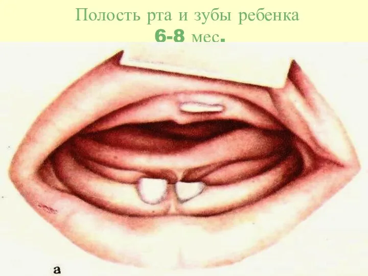 Полость рта и зубы ребенка 6-8 мес.