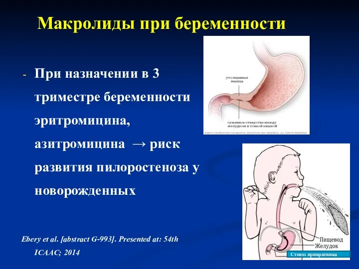 Макролиды при беременности При назначении в 3 триместре беременности эритромицина, азитромицина