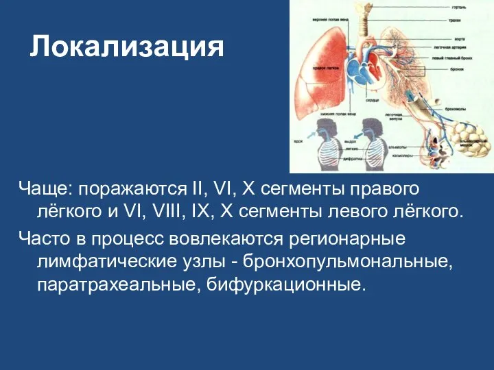 Локализация Чаще: поражаются II, VI, X сегменты правого лёгкого и VI,