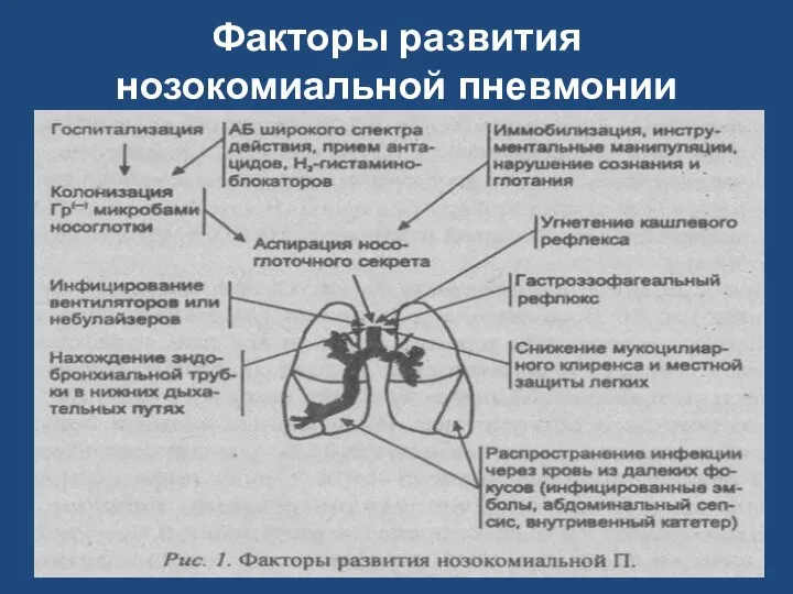 Факторы развития нозокомиальной пневмонии