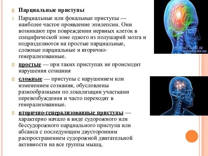 Парциальные приступы Парциальные или фокальные приступы — наиболее частое проявление эпилепсии.