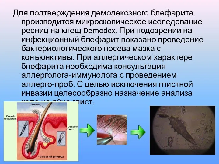 Для подтверждения демодекозного блефарита производится микроскопическое исследование ресниц на клещ Demodex.