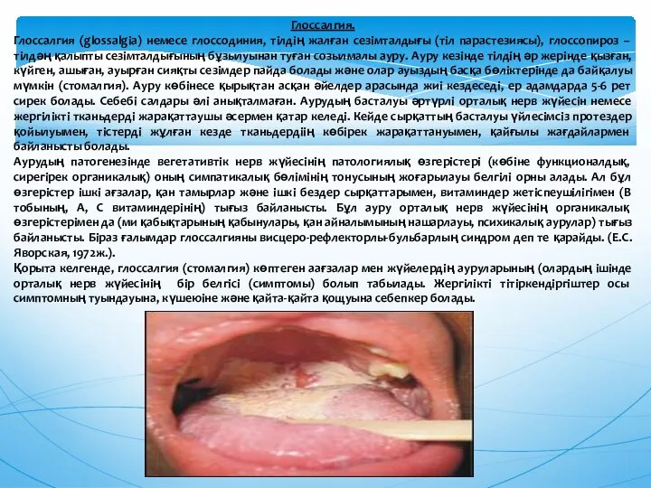 Глоссалгия. Глоссалгия (glossalgia) немесе глоссодиния, тiлдiң жалған сезiмталдығы (тiл парастезиясы), глоссопироз