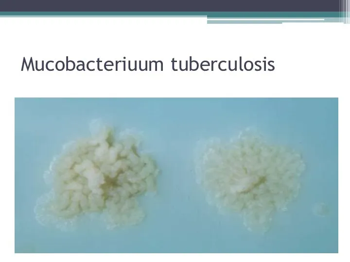 Mucobacteriuum tuberculosis