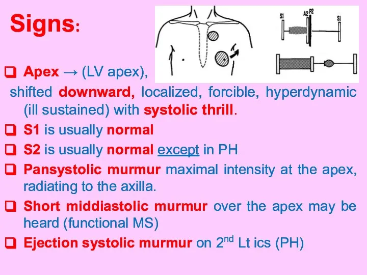 Signs: Apex → (LV apex), shifted downward, localized, forcible, hyperdynamic (ill