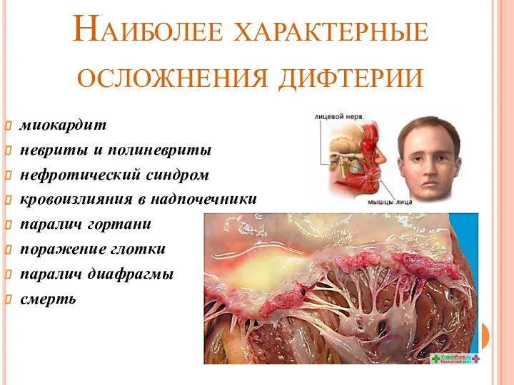 Наиболее характерные осложнения дифтерии миокардит невриты и полиневриты нефротический синдром кровоизлияния