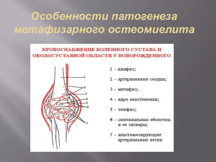 Особенности патогенеза метафизарного остеомиелита