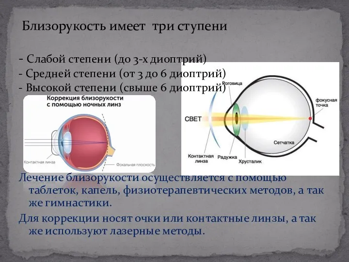 Лечение близорукости осуществляется с помощью таблеток, капель, физиотерапевтических методов, а так