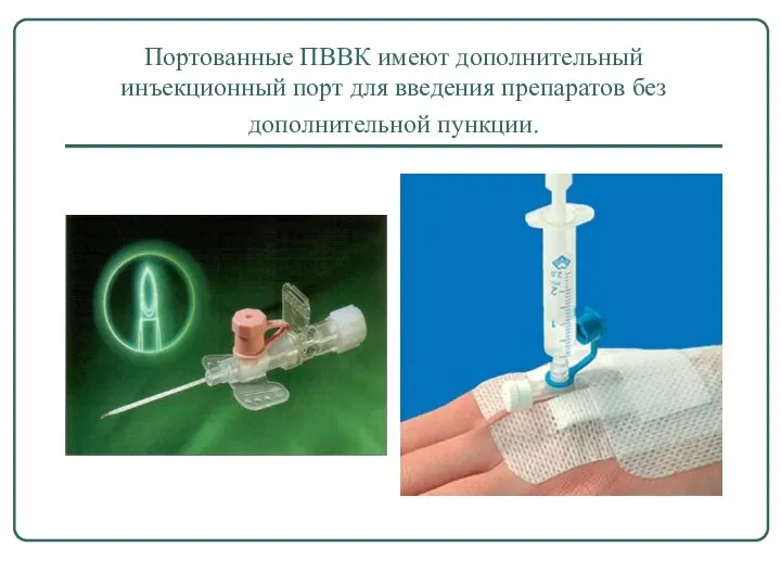 Портованные ПВВК имеют дополнительный инъекционный порт для введения препаратов без дополнительной пункции.