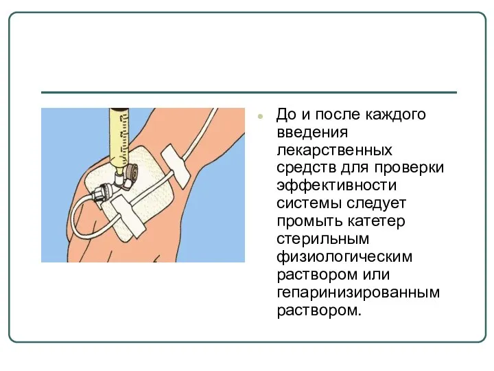 До и после каждого введения лекарственных средств для проверки эффективности системы