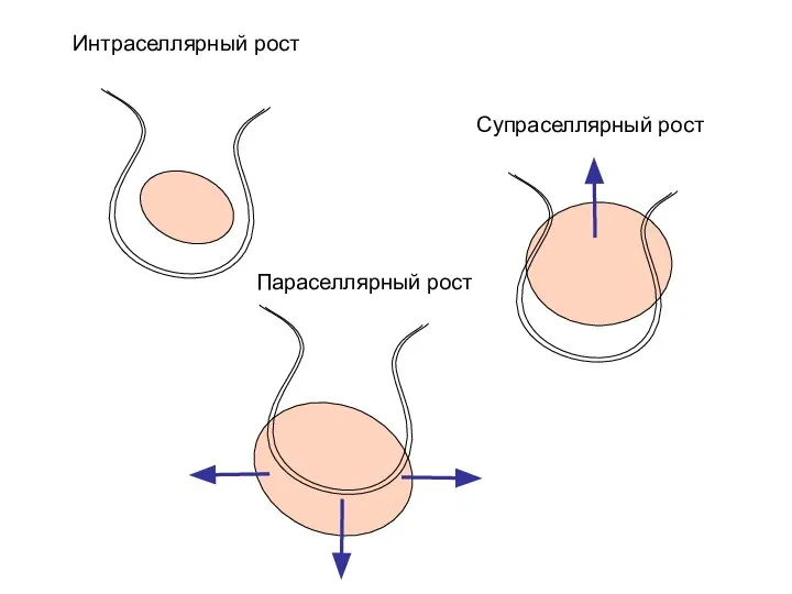 Интраселлярный рост Супраселлярный рост Параселлярный рост