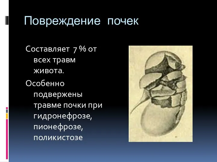 Повреждение почек Составляет 7 % от всех травм живота. Особенно подвержены