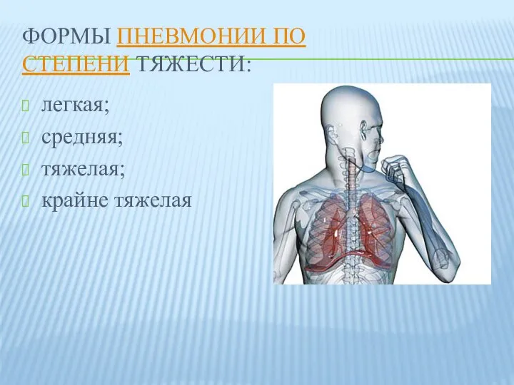 ФОРМЫ ПНЕВМОНИИ ПО СТЕПЕНИ ТЯЖЕСТИ: легкая; средняя; тяжелая; крайне тяжелая