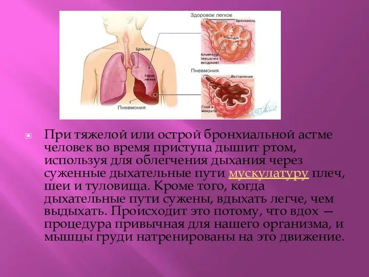 При тяжелой или острой бронхиальной астме человек во время приступа дышит