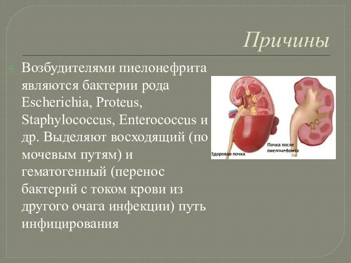 Причины Возбудителями пиелонефрита являются бактерии рода Escherichia, Proteus, Staphylococcus, Enterococcus и