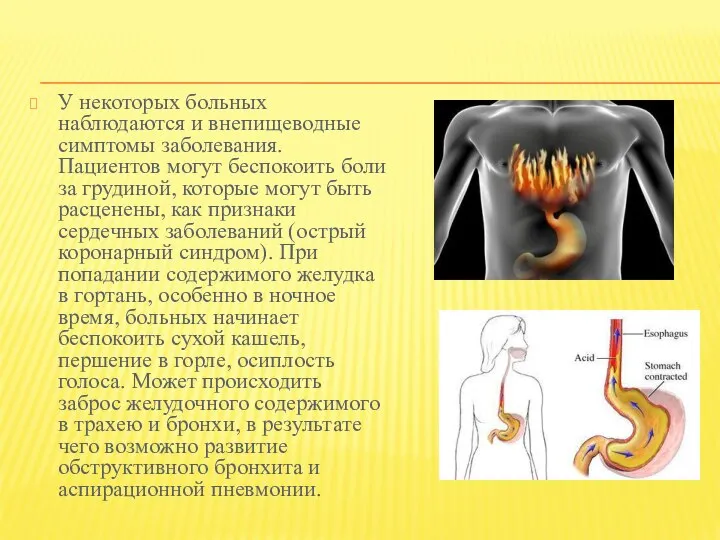 У некоторых больных наблюдаются и внепищеводные симптомы заболевания. Пациентов могут беспокоить