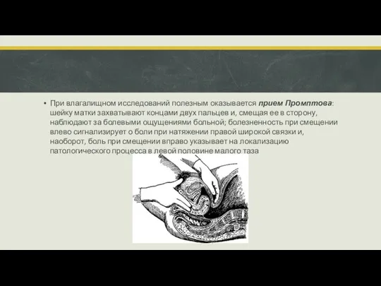 При влагалищном исследований полезным оказывается прием Промптова: шейку матки захватывают концами