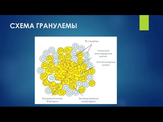 СХЕМА ГРАНУЛЕМЫ Th I-клетки Гиганские многоядерные клетки Эпителиоидные клетки Активированные макрофаги Внутриклеточные бактерии