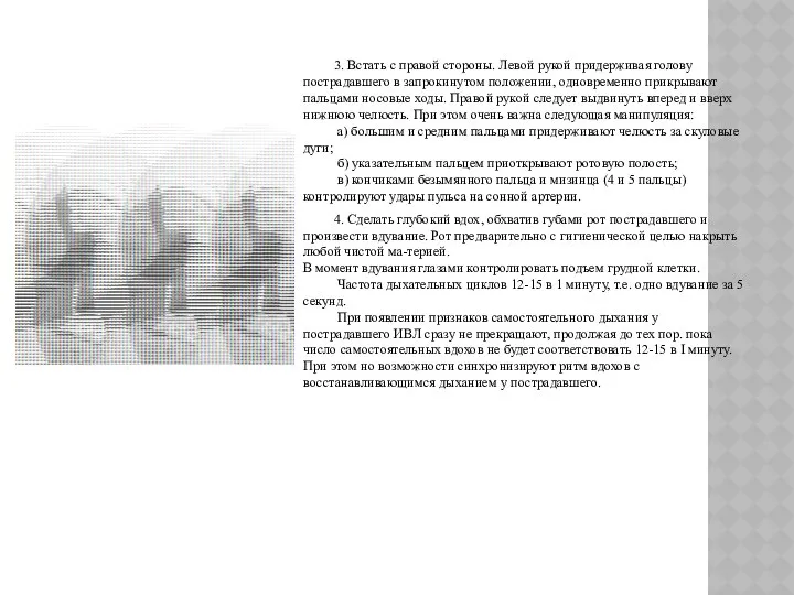 3. Встать с правой стороны. Левой рукой придерживая голову пострадавшего в