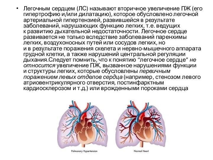 Легочным сердцем (ЛС) называют вторичное увеличение ПЖ (его гипертрофию и/или дилатацию),