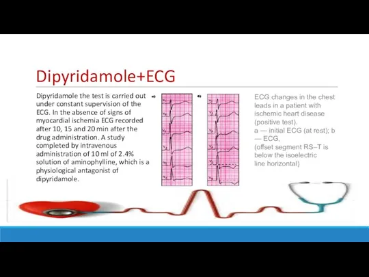 Dipyridamole+ECG Dipyridamole the test is carried out under constant supervision of