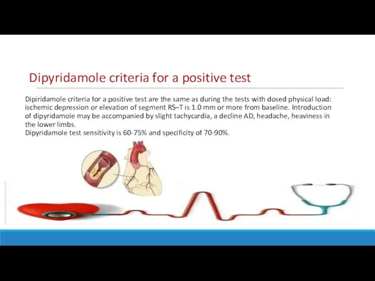 Dipiridamole criteria for a positive test are the same as during