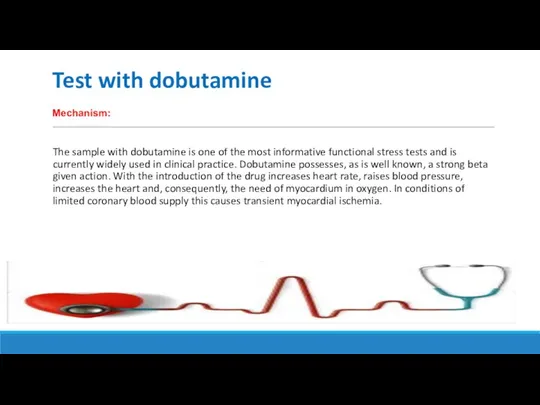 Test with dobutamine The sample with dobutamine is one of the