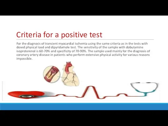 Criteria for a positive test For the diagnosis of transient myocardial