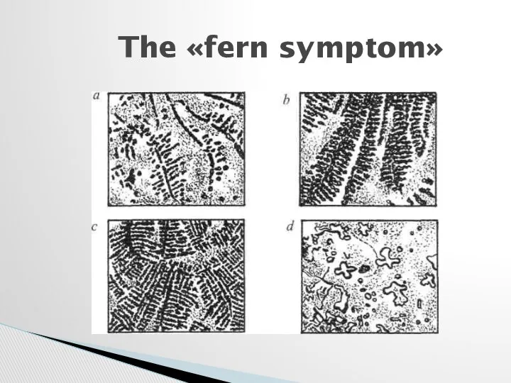 The «fern symptom»