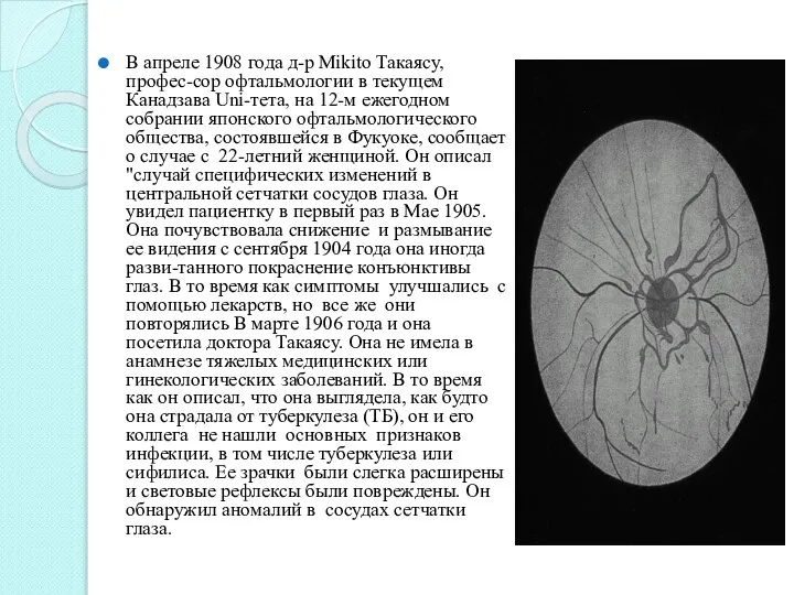 В апреле 1908 года д-р Mikito Такаясу, профес-сор офтальмологии в текущем