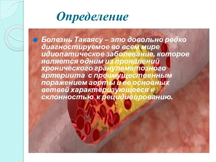 Определение Болезнь Такаясу – это довольно редко диагностируемое во всем мире