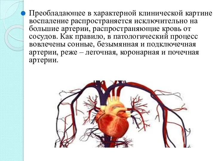 Преобладающее в характерной клинической картине воспаление распространяется исключительно на большие артерии,