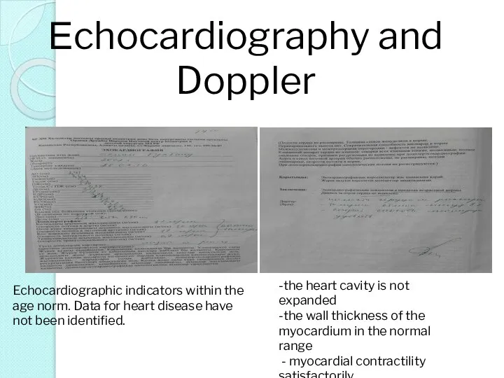 Еchocardiography and Doppler -the heart cavity is not expanded -the wall