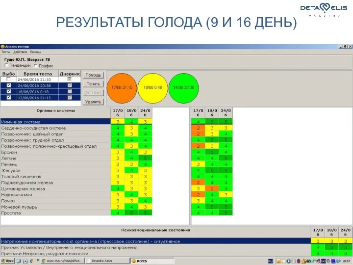 РЕЗУЛЬТАТЫ ГОЛОДА (9 И 16 ДЕНЬ)