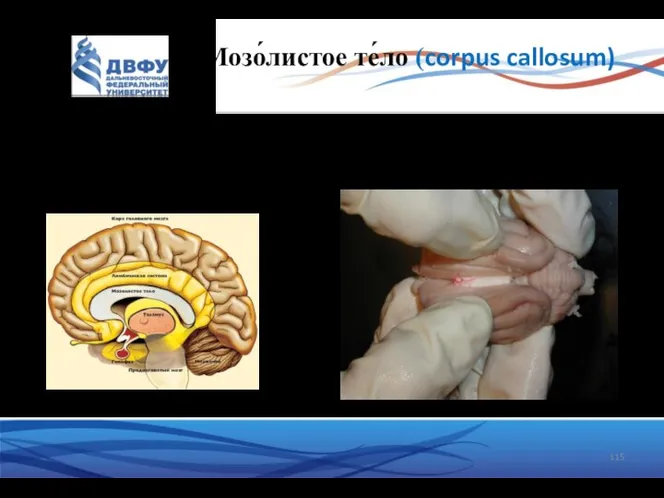 Мозо́листое те́ло (corpus callosum) самое крупное скопление нервных волокон в нервной