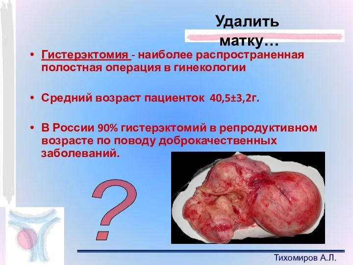 Тихомиров А.Л. Гистерэктомия - наиболее распространенная полостная операция в гинекологии Средний