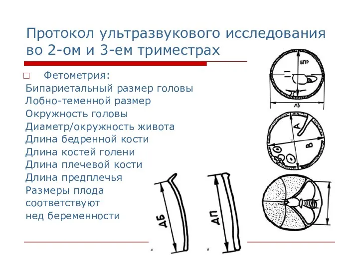 Протокол ультразвукового исследования во 2-ом и 3-ем триместрах Фетометрия: Бипариетальный размер