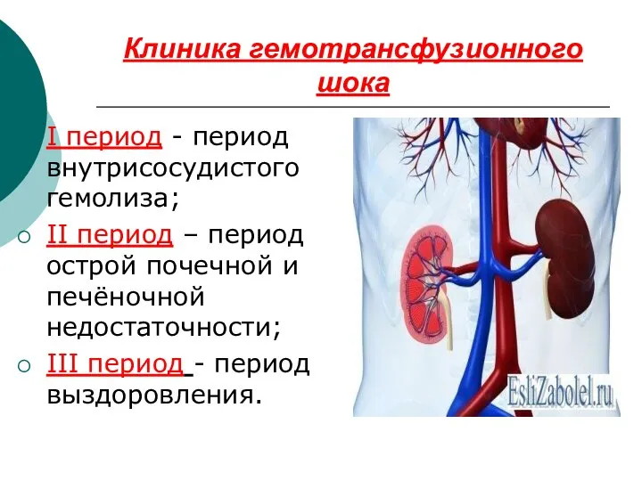 Клиника гемотрансфузионного шока I период - период внутрисосудистого гемолиза; II период