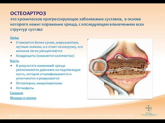 Хрящ Становится более сухим, шероховатым, мутным ломким, и в ответ на