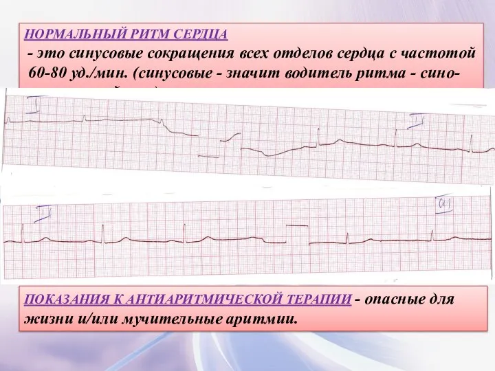 НОРМАЛЬНЫЙ РИТМ СЕРДЦА - это синусовые сокращения всех отделов сердца с