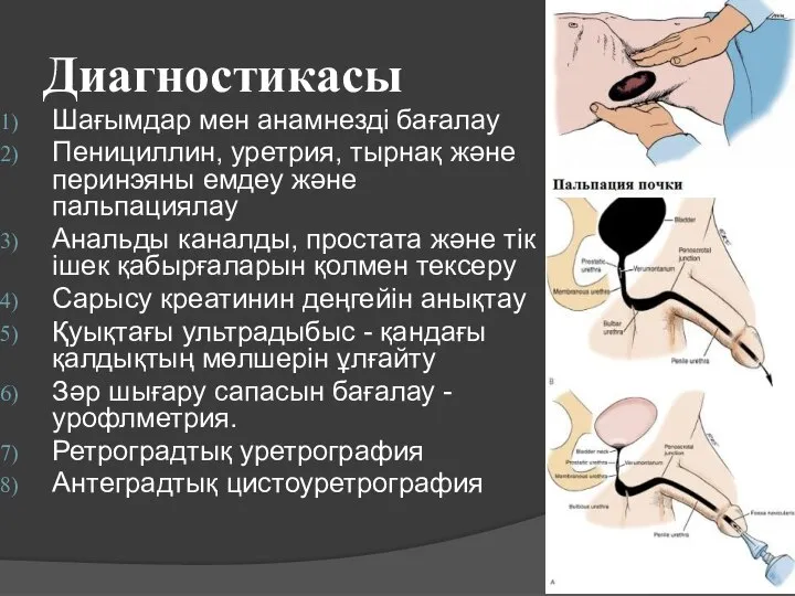 Диагностикасы Шағымдар мен анамнезді бағалау Пенициллин, уретрия, тырнақ және перинэяны емдеу