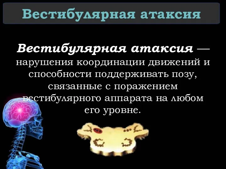 Вестибулярная атаксия Вестибулярная атаксия — нарушения координации движений и способности поддерживать