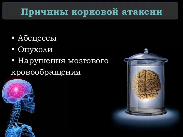 Причины корковой атаксии Абсцессы Опухоли Нарушения мозгового кровообращения