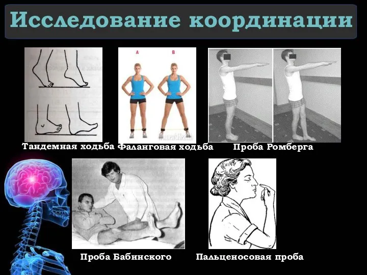 Исследование координации Тандемная ходьба Фаланговая ходьба Проба Ромберга Проба Бабинского Пальценосовая проба