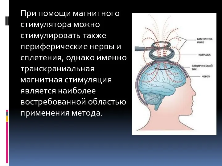 При помощи магнитного стимулятора можно стимулировать также периферические нервы и сплетения,