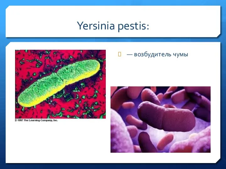Yersinia pestis: — возбудитель чумы