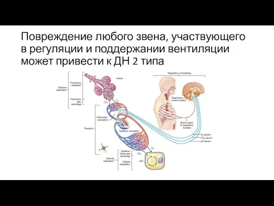 Повреждение любого звена, участвующего в регуляции и поддержании вентиляции может привести к ДН 2 типа