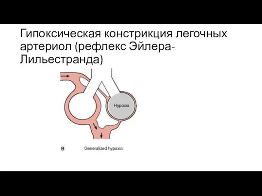 Гипоксическая констрикция легочных артериол (рефлекс Эйлера-Лильестранда)