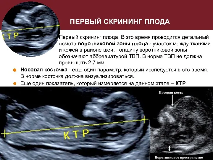 ПЕРВЫЙ СКРИНИНГ ПЛОДА Первый скрининг плода. В это время проводится детальный